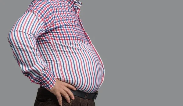 10 Cara Mencegah dan Mengatasi Obesitas