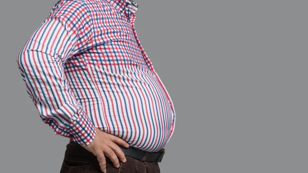 10 Cara Mencegah dan Mengatasi Obesitas