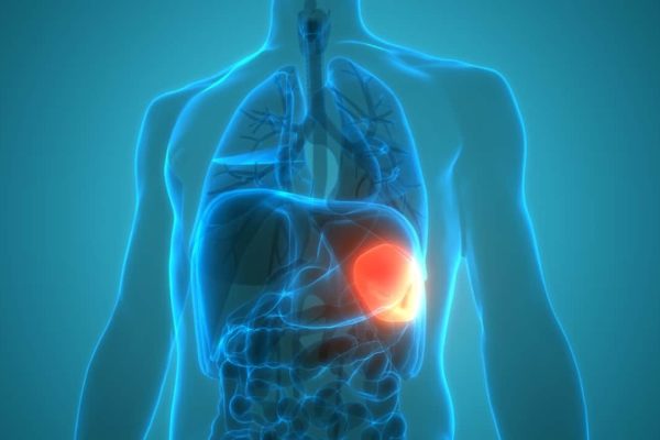 5 Hal yang Perlu Dihindari Agar Limpa Tetap Optimal 5 Hal yang Perlu Dihindari Agar Limpa Tetap Optimal