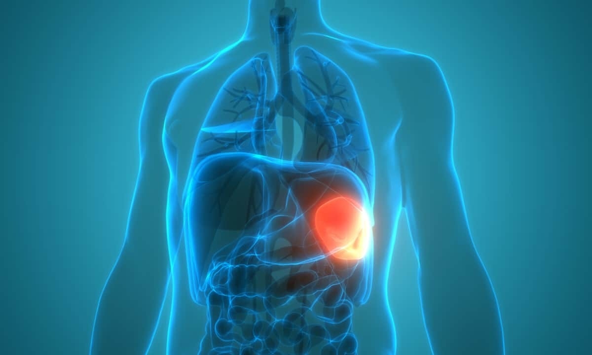 5 Hal yang Perlu Dihindari Agar Limpa Tetap Optimal