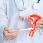 10 Cara Pencegahan Kanker Leher Rahim Sejak Usia Muda