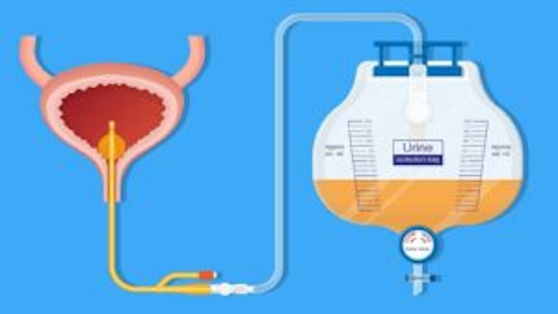 5 Langkah Cegah Infeksi Saluran Kemih pada Pasien Lumpuh