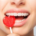 7 Makanan yang Harus Dihindari untuk Gigi Lebih Sehat