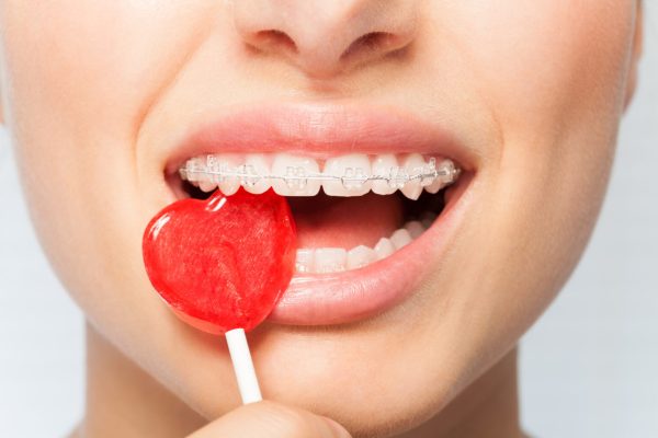 7 Makanan yang Harus Dihindari untuk Gigi Lebih Sehat