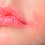 10 Cara Merawat Bibir agar Tidak Mudah Terinfeksi