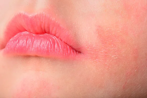 10 Cara Merawat Bibir agar Tidak Mudah Terinfeksi